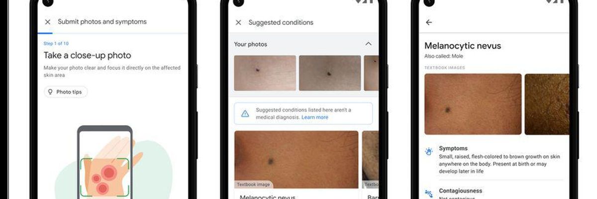 Bőrgyógyászati segédeszközt mutatott be a Google
