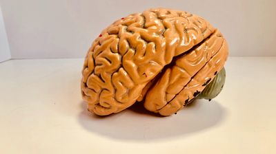 Egy agyat ábrázoló figura.
