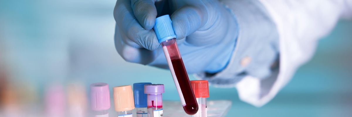 Először találtak mikroműanyagokat az emberi vérben