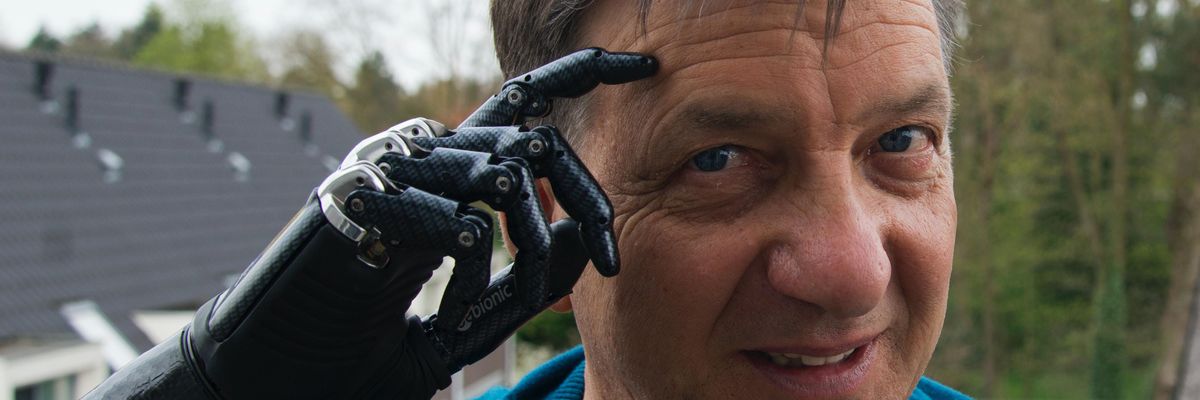 man with black robotic hands smiling