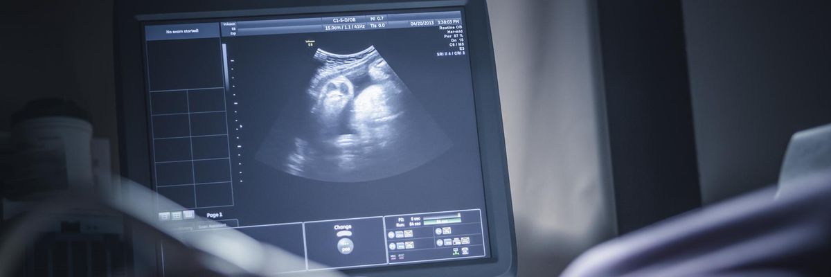 ultrahangos felvétel egy magzatról egy terhes kismama hasáról