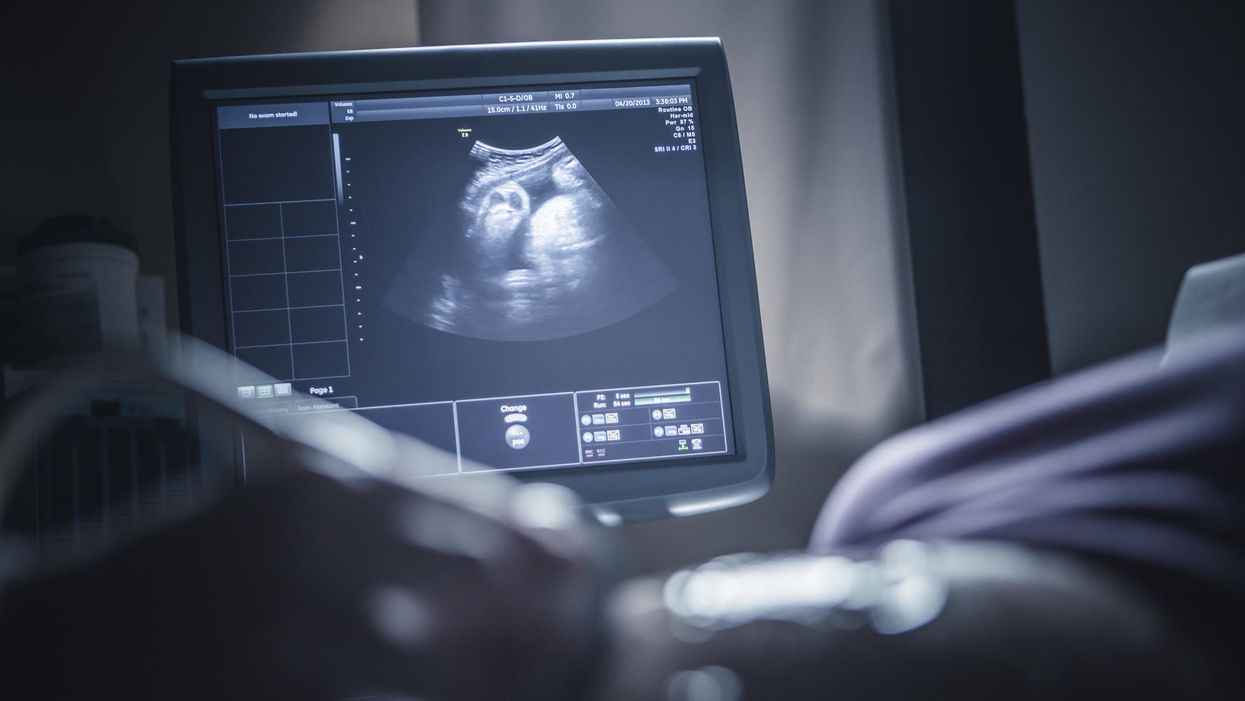 ultrahangos felvétel egy magzatról egy terhes kismama hasáról