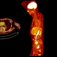 Radiological imaging/Shutterstock.com