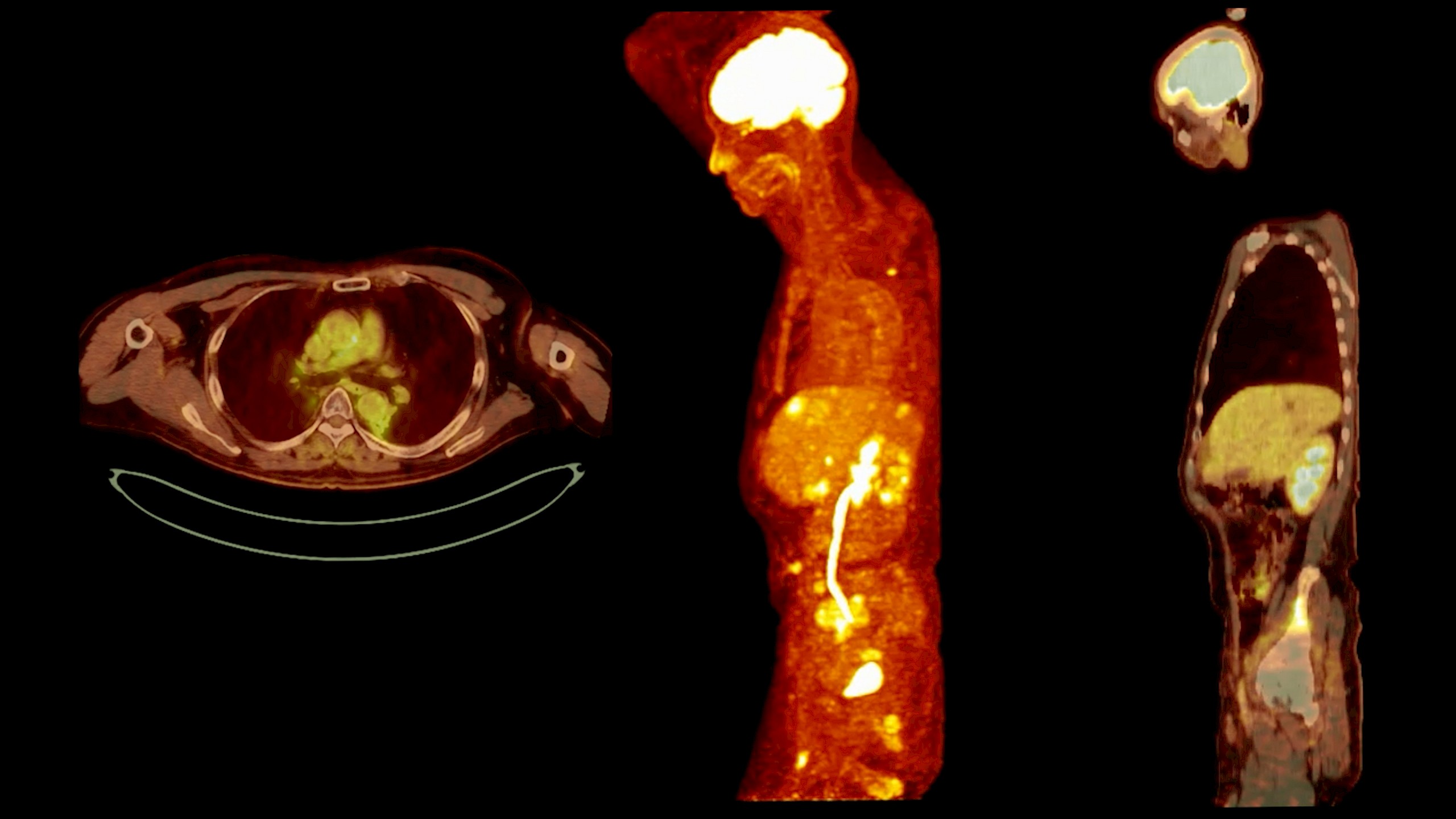 Radiological imaging/Shutterstock.com