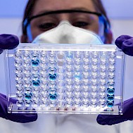 Fot&oacute;: unsplash