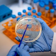 Betul Abali/Anadolu via Getty Images