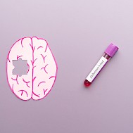 Orawan Pattarawimonchai/Shutterstock.com