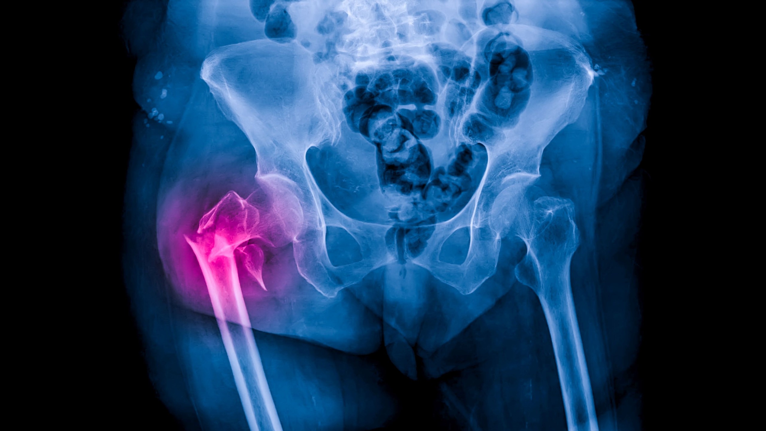 Peter Porrini/Shutterstock.com